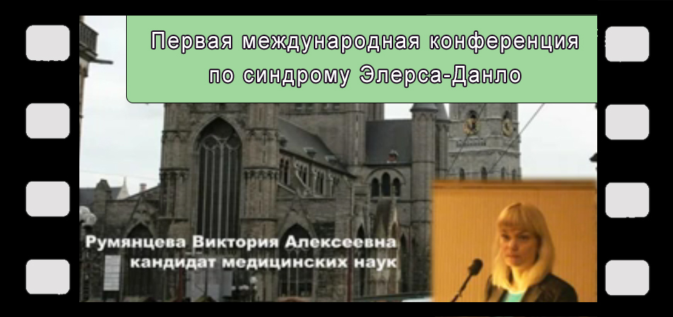 Синдром Элерса-Данлоса, дисплазия соединительной ткани