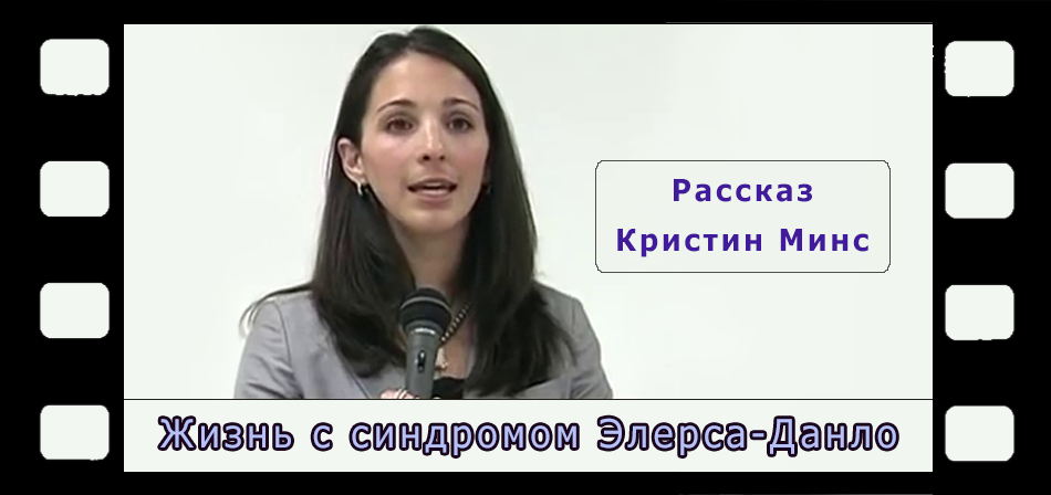 Синдром Элерса-Данлоса